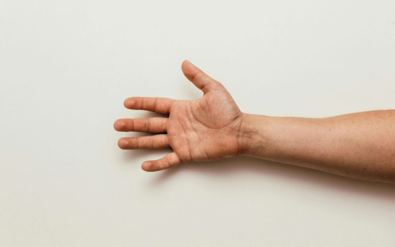 mano-tebo-traumatologos-cirugia-de-mano-en-guatemala-1